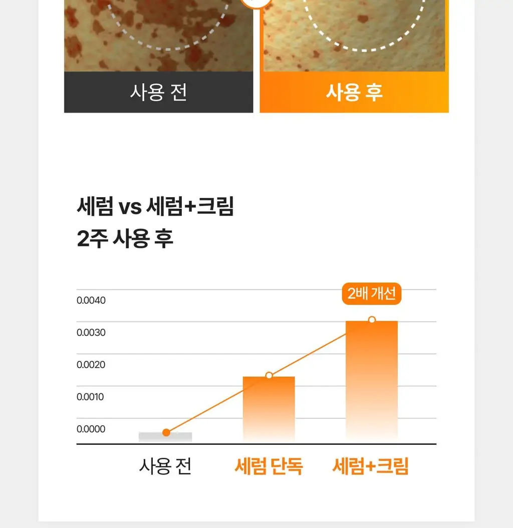 [흔적,기미,미백/TXA] 셀리맥스 트라넥삼산 잡티 크림 35ml 상세페이지 42
